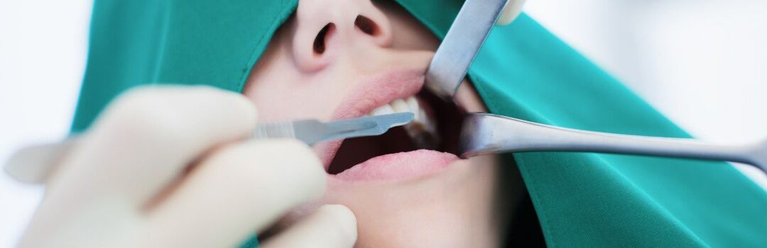 Cómo prevenir la gingivitis: todo lo que necesitas saber